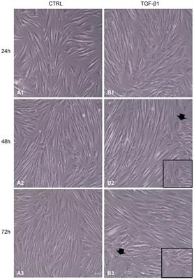 Transforming Growth Factor-Beta1 and Human Gingival Fibroblast-to-Myofibroblast Differentiation: Molecular and Morphological Modifications